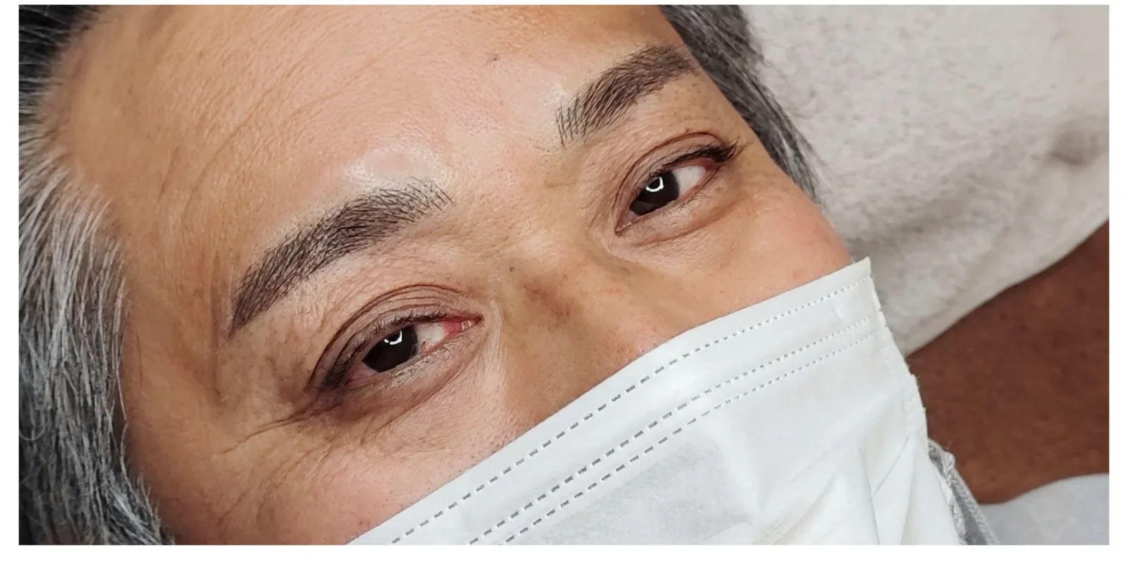 眉アートメイク 症例B Before/After After