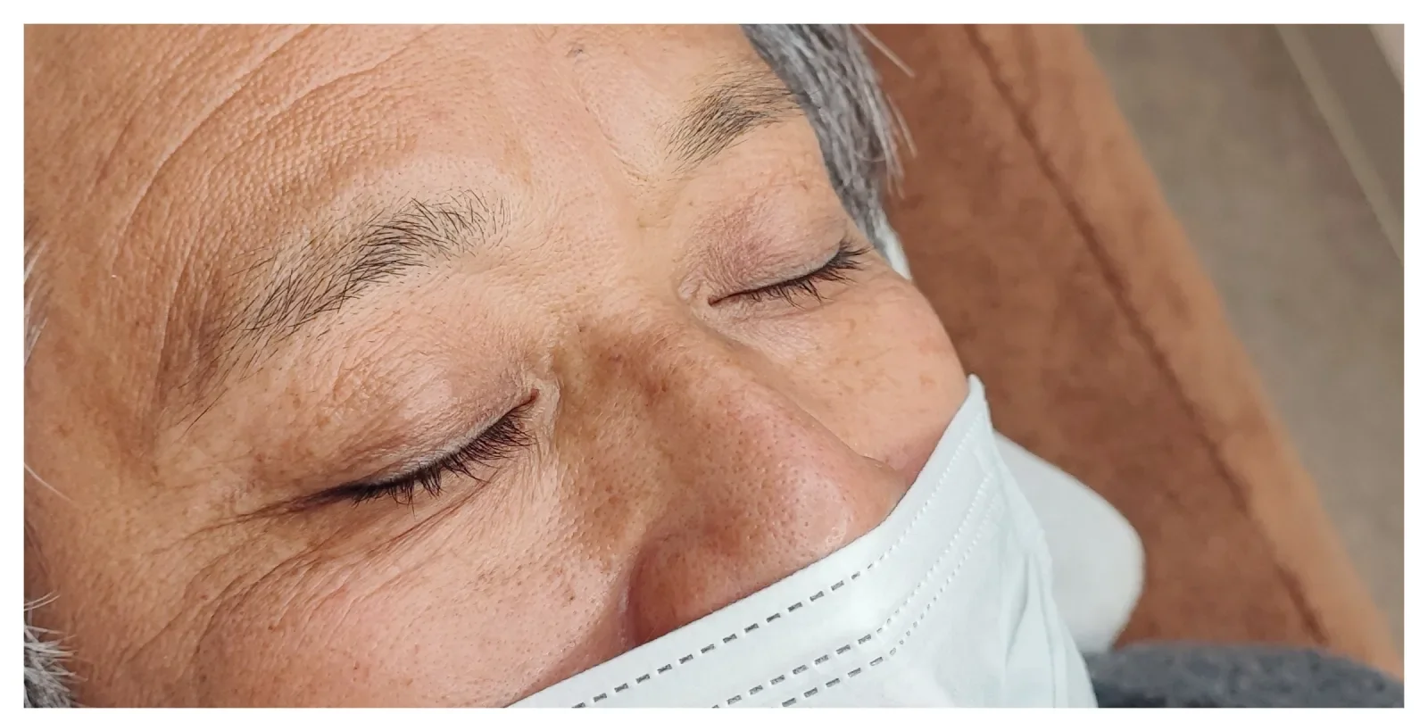 眉アートメイク 症例B Before/After Before