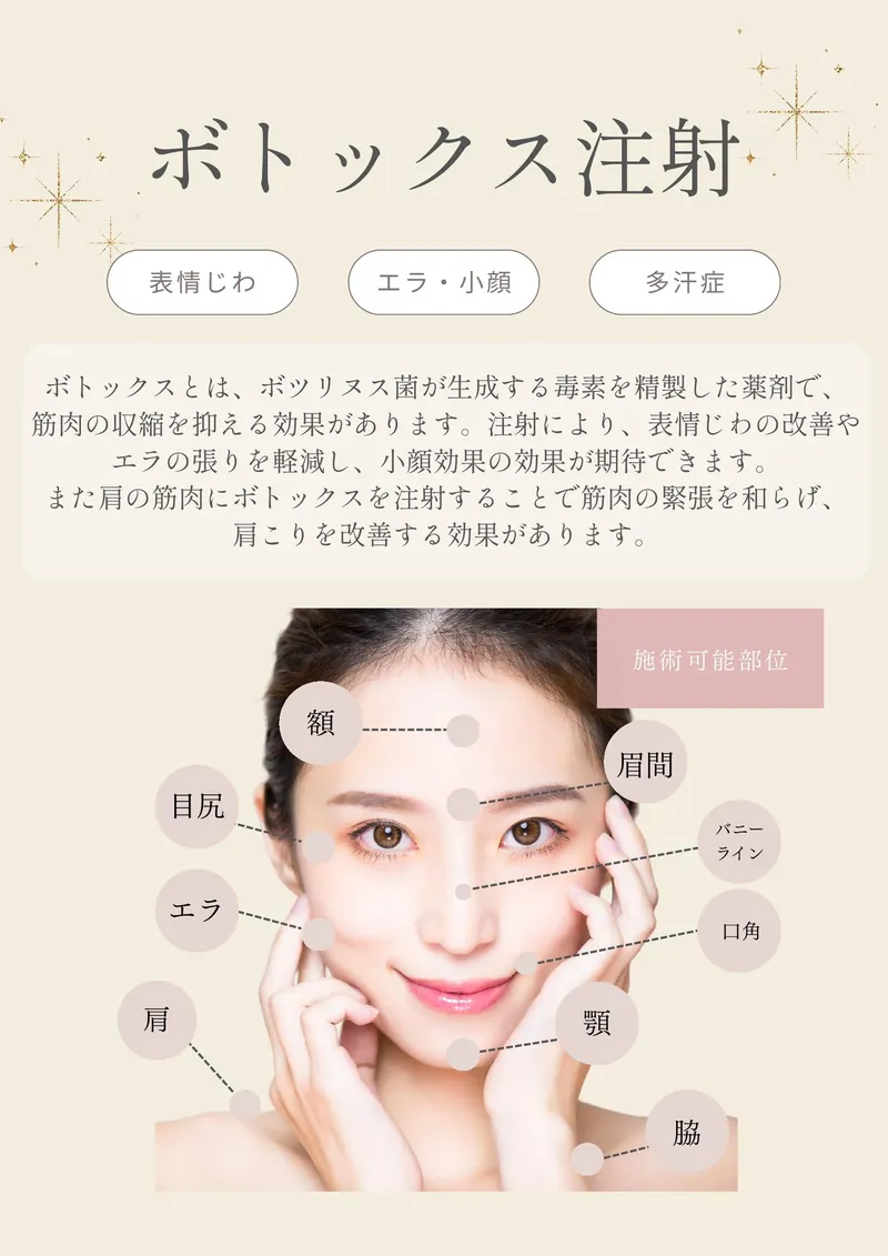 ボトックス（シワ取り・エラ改善注射）の施術可能部位